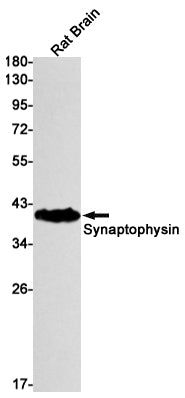 Anti-Synaptophysin Rabbit Monoclonal Antibody