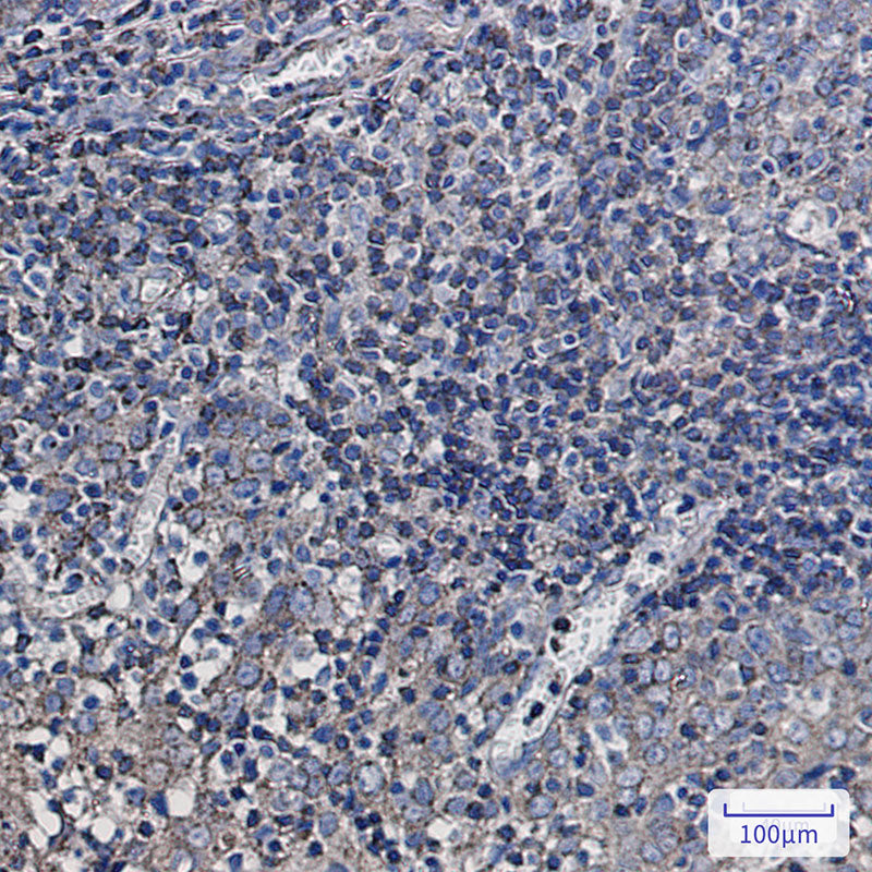 Anti-Synaptophysin Like Protein 1 Rabbit Monoclonal Antibody