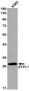 Anti-Synaptophysin Like Protein 1 Rabbit Monoclonal Antibody