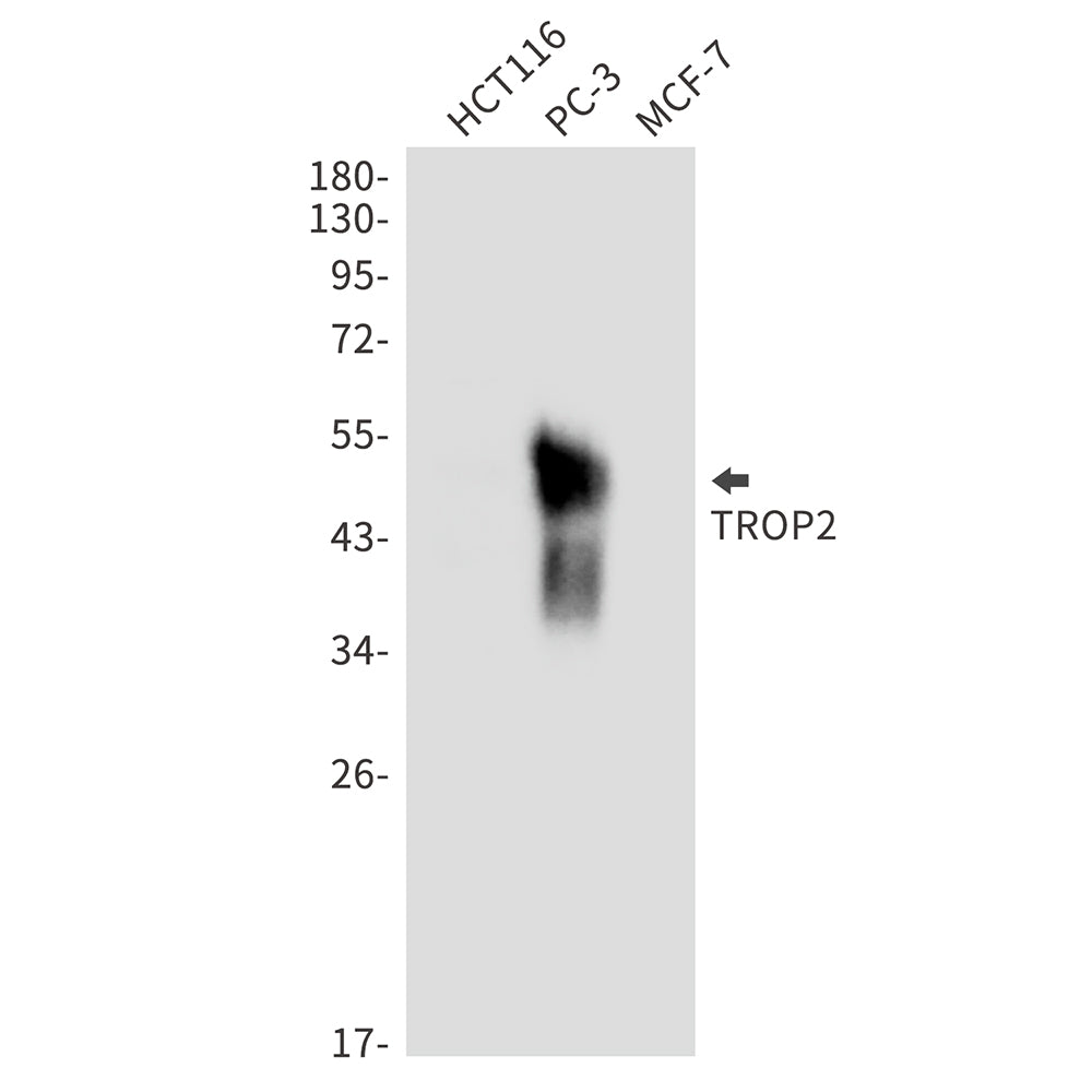Anti-TACSTD2 Rabbit Monoclonal Antibody