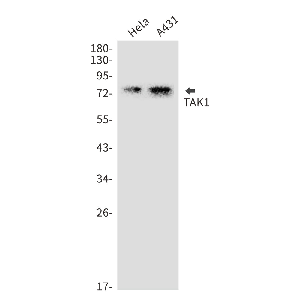 Anti-TAK1 Rabbit Monoclonal Antibody