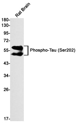 Anti-Phospho-Tau (Ser202) Rabbit Monoclonal Antibody