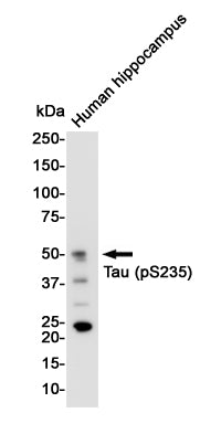 Anti-Phospho-Tau (Ser235) Rabbit Monoclonal Antibody