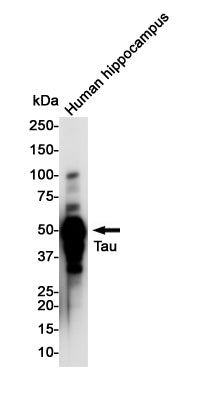 Anti-Tau Rabbit Monoclonal Antibody