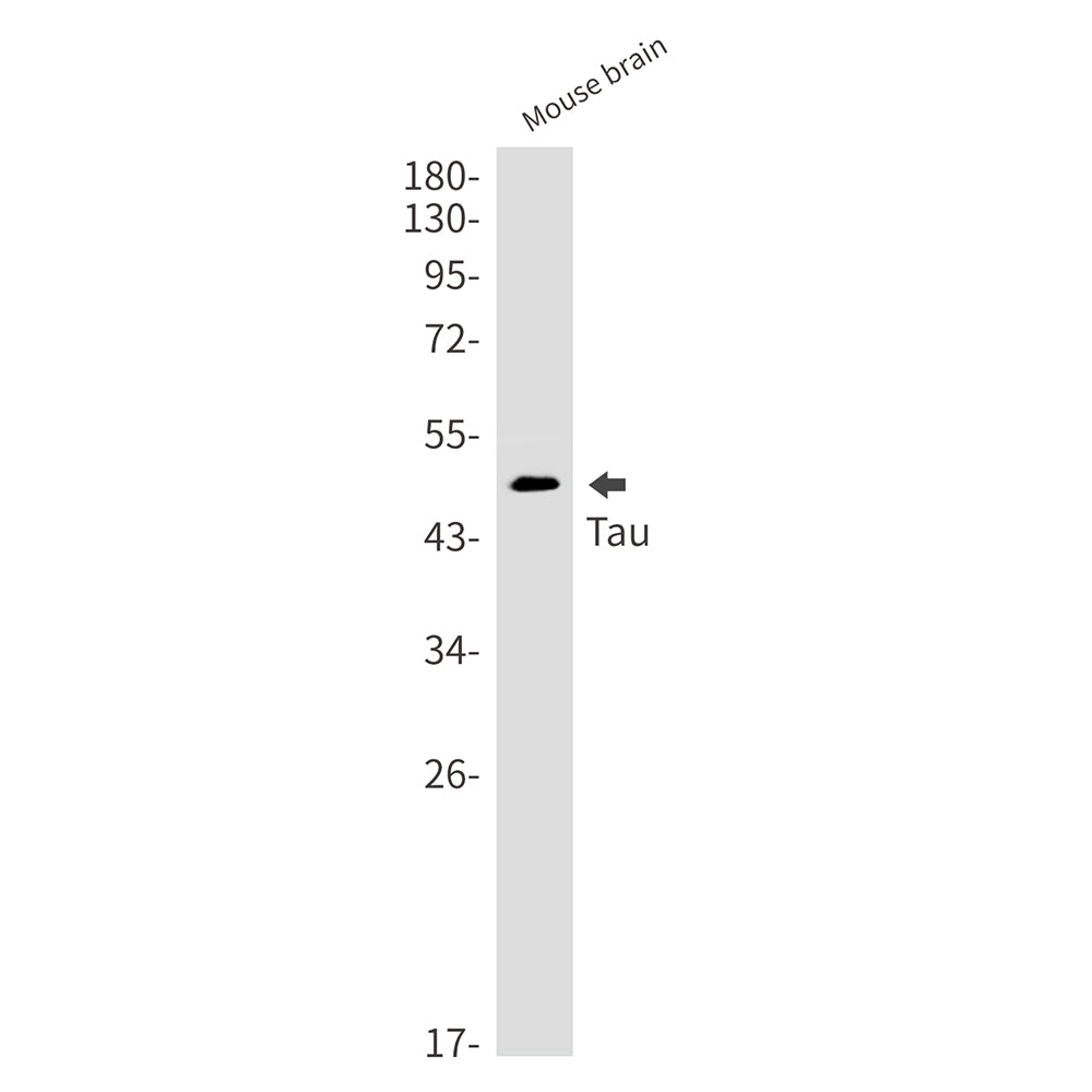 Anti-Tau Rabbit Monoclonal Antibody
