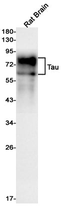 Anti-Tau Rabbit Monoclonal Antibody