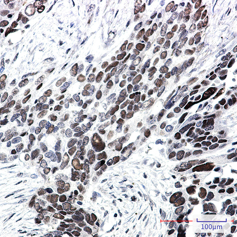 Anti-Transcription Factor 7 Like 2 Rabbit Monoclonal Antibody