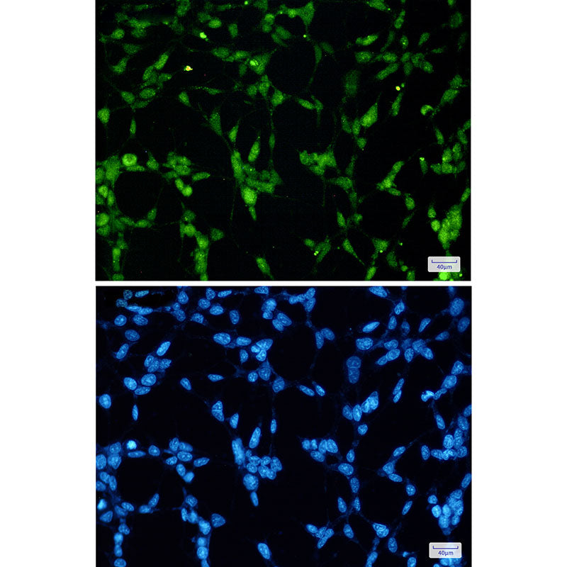Anti-TDP 43 Rabbit Monoclonal Antibody