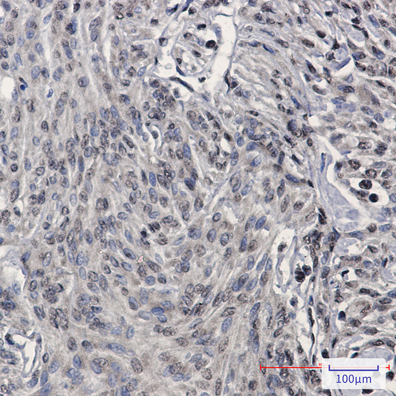 Anti-TDP 43 Rabbit Monoclonal Antibody