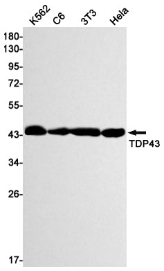 Anti-TDP 43 Rabbit Monoclonal Antibody