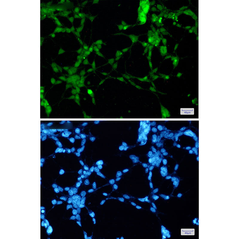 Anti-TDP 43 Rabbit Monoclonal Antibody