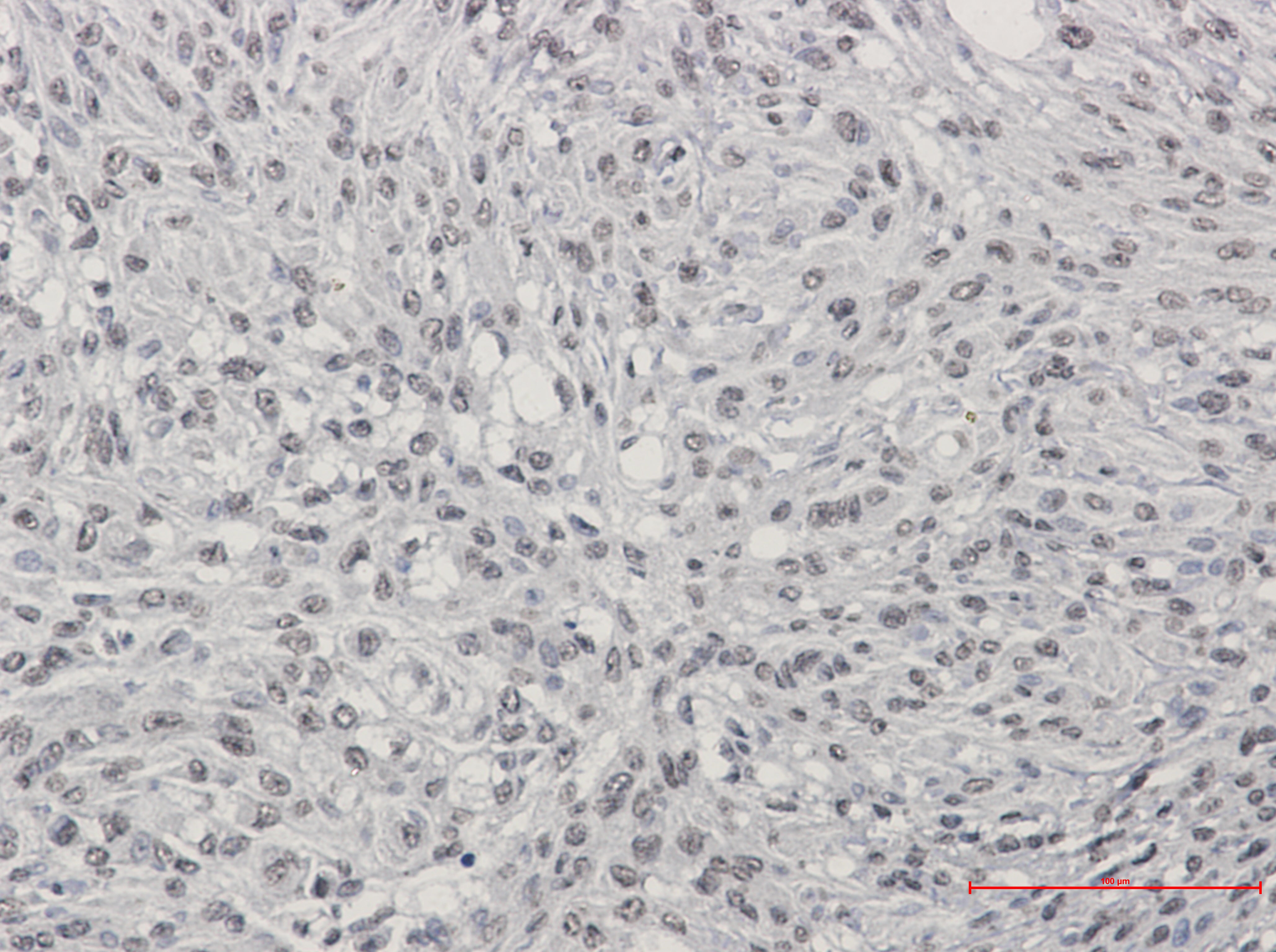 Anti-TDP 43 Rabbit Monoclonal Antibody