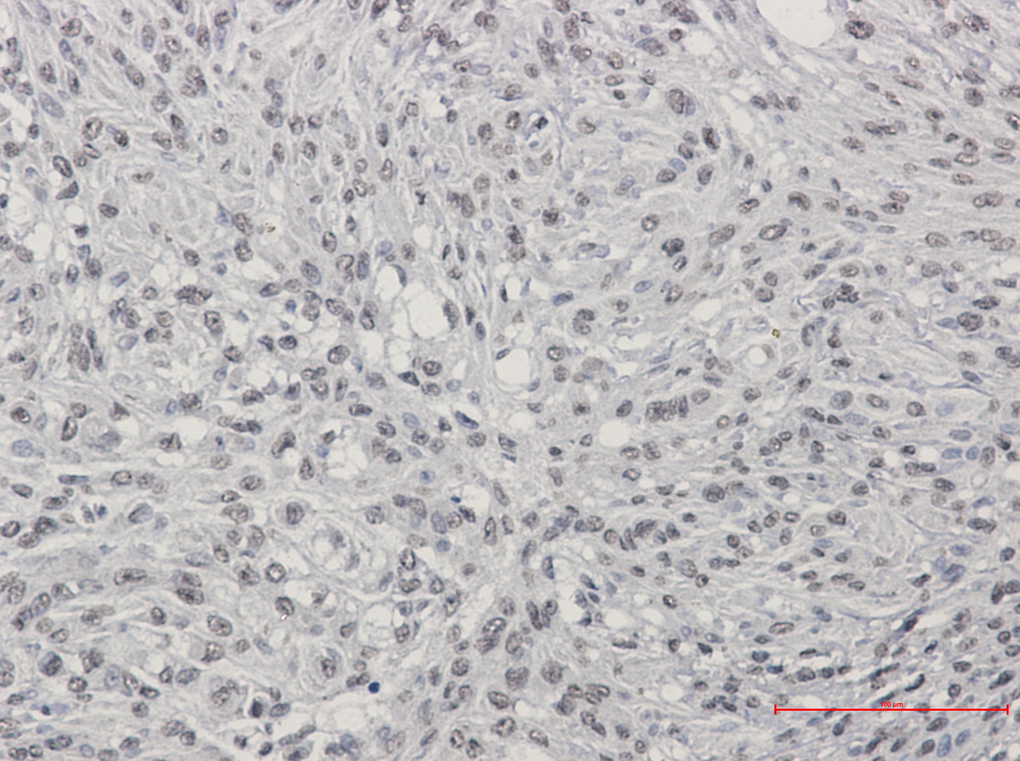 Anti-TDP 43 Rabbit Monoclonal Antibody