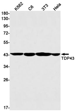Anti-TDP 43 Rabbit Monoclonal Antibody