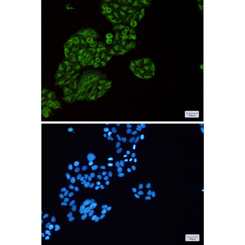 Anti-Tec Rabbit Monoclonal Antibody