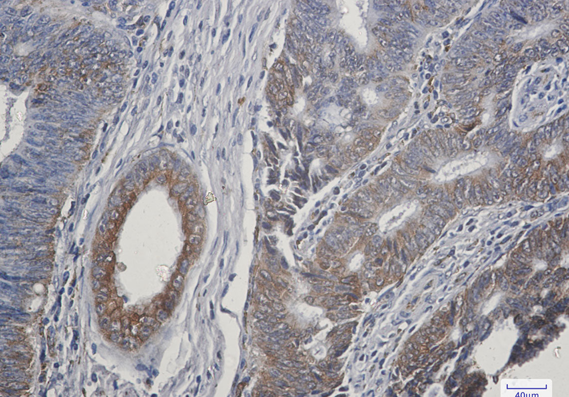 Anti-TGF alpha Rabbit Monoclonal Antibody