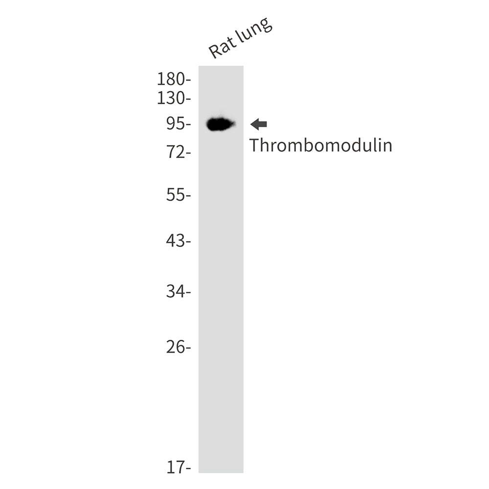 Anti-Thrombomodulin Rabbit Monoclonal Antibody