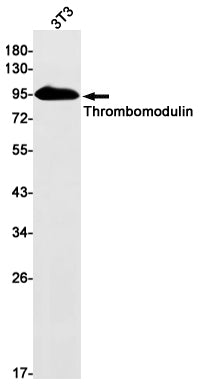 Anti-Thrombomodulin Rabbit Monoclonal Antibody