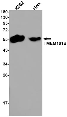 Anti-Transmembrane Protein 161B Rabbit Monoclonal Antibody