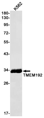Anti-Transmembrane Protein 192 Rabbit Monoclonal Antibody
