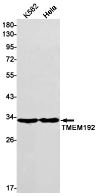 Anti-Transmembrane Protein 192 Rabbit Monoclonal Antibody
