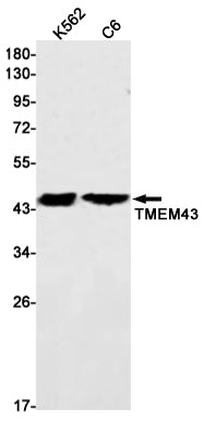 Anti-Transmembrane Protein 43 Rabbit Monoclonal Antibody