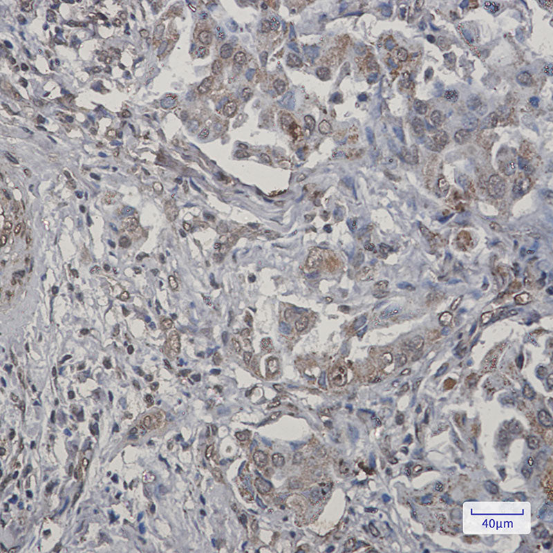 Anti-TNFAIP3 Rabbit Monoclonal Antibody