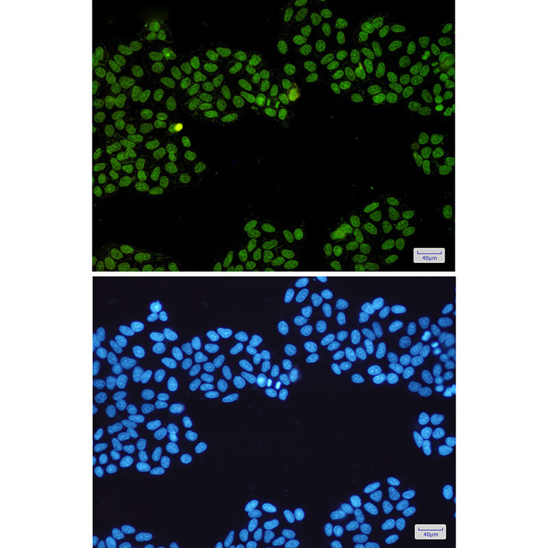 Anti-Topoisomerase I Rabbit Monoclonal Antibody