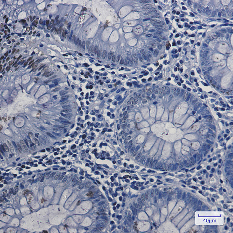 Anti-Topoisomerase I Rabbit Monoclonal Antibody