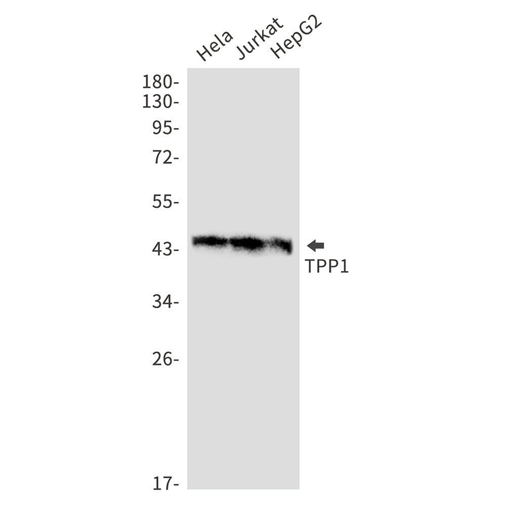 Anti-TPP1 Rabbit Monoclonal Antibody