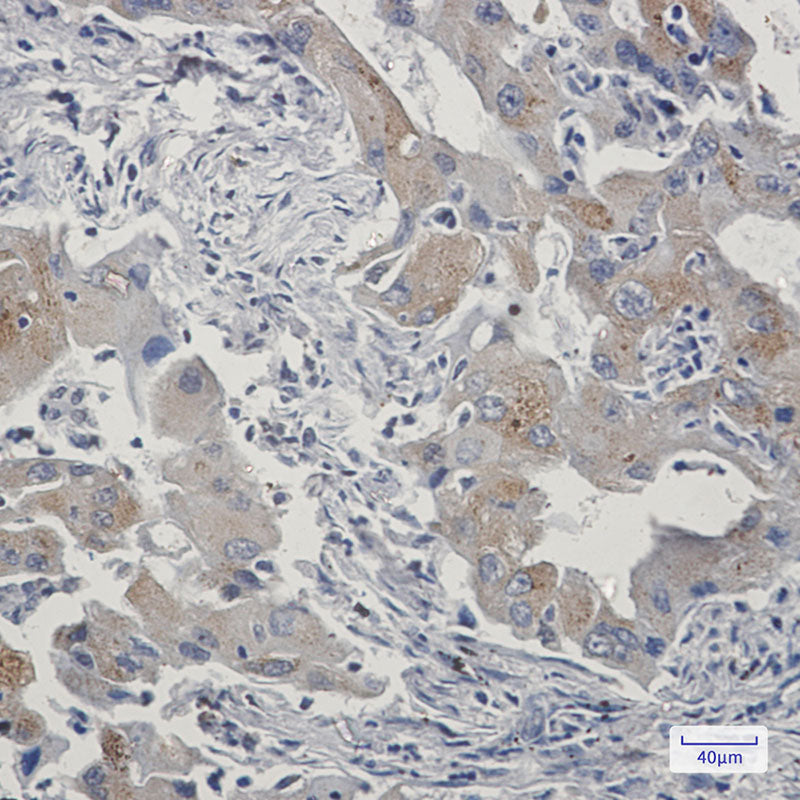 Anti-TAX1BP1 Rabbit Monoclonal Antibody