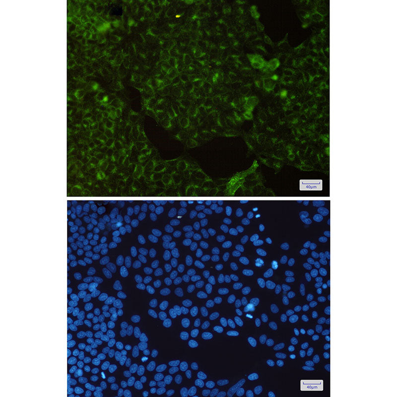 Anti-Transferrin Receptor 1 Rabbit Monoclonal Antibody