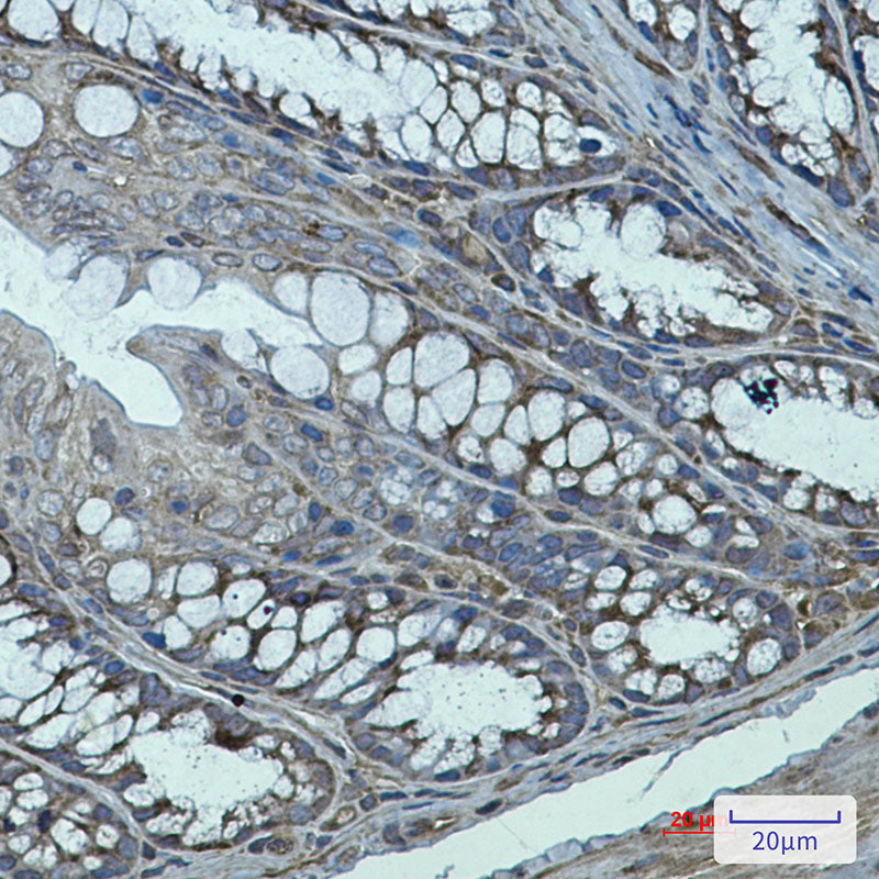 Anti-Transglutaminase 2 Rabbit Monoclonal Antibody