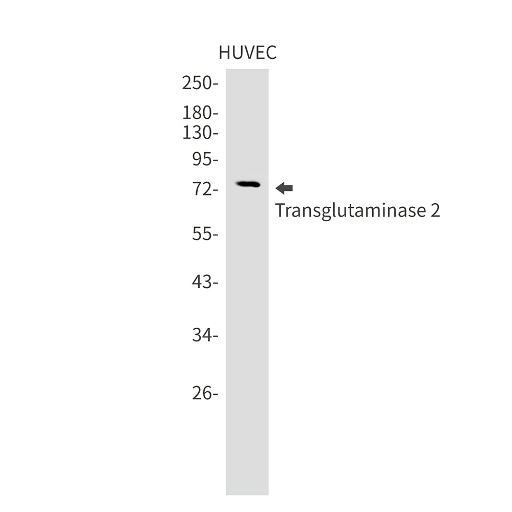 Anti-Transglutaminase 2 Rabbit Monoclonal Antibody