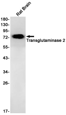 Anti-Transglutaminase 2 Rabbit Monoclonal Antibody