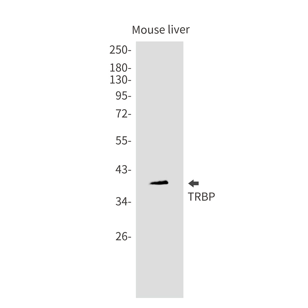 Anti-TARBP2 Rabbit Monoclonal Antibody