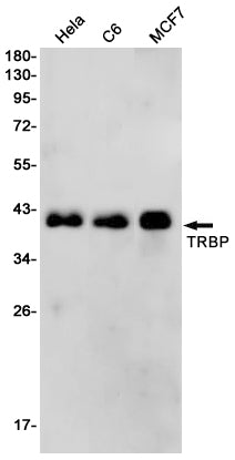 Anti-TARBP2 Rabbit Monoclonal Antibody