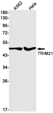 Anti-TRIM21 Rabbit Monoclonal Antibody