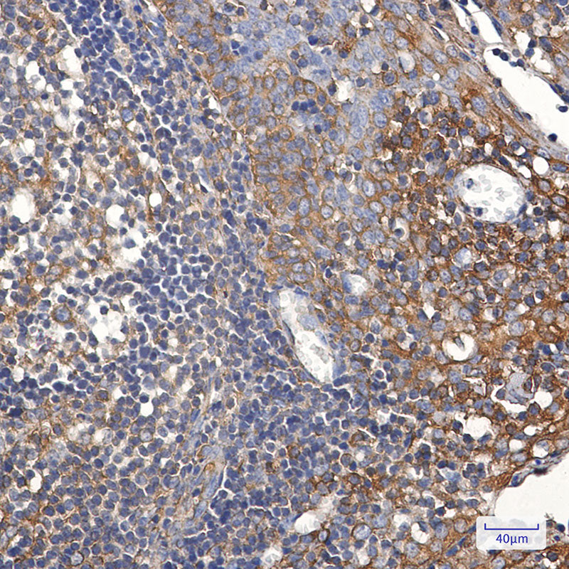 Anti-TFG Rabbit Monoclonal Antibody