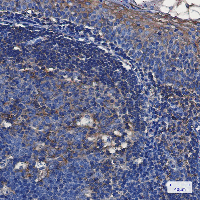 Anti-TFG Rabbit Monoclonal Antibody