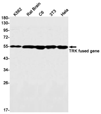 Anti-TFG Rabbit Monoclonal Antibody
