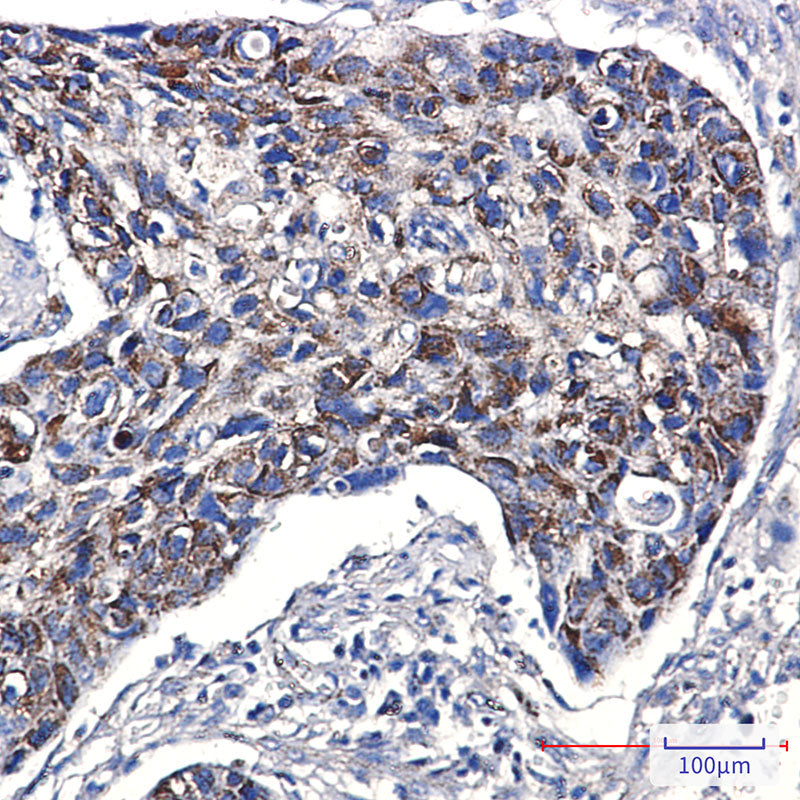 Anti-Mitochondrial Fission 1 Protein Rabbit Monoclonal Antibody