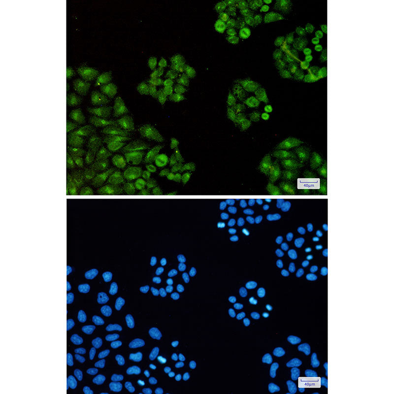 Anti-Transcription Termination Factor 2 Rabbit Monoclonal Antibody