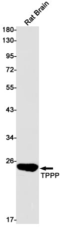 Anti-TPPP Rabbit Monoclonal Antibody