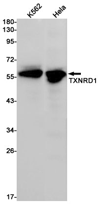 Anti-Thioredoxin Reductase 1 Rabbit Monoclonal Antibody