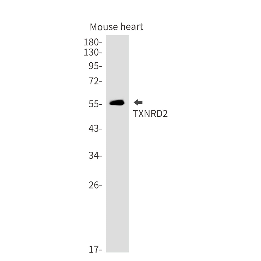 Anti-Thioredoxin Reductase 2 Rabbit Monoclonal Antibody