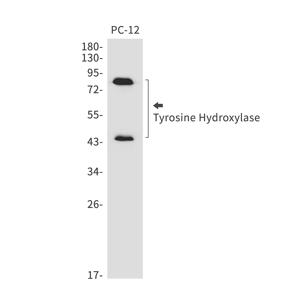 Anti-Tyrosine Hydroxylase Rabbit Monoclonal Antibody