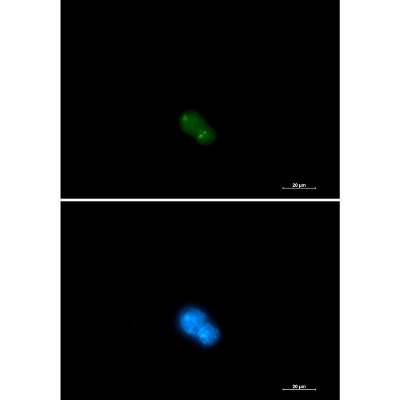 Anti-UBA2 Rabbit Monoclonal Antibody