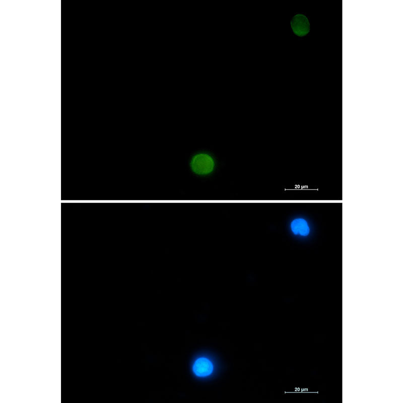 Anti-Ubiquitin Rabbit Monoclonal Antibody
