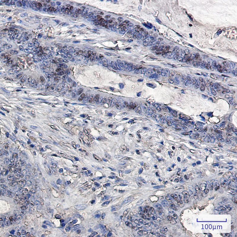 Anti-Ubiquitin Rabbit Monoclonal Antibody